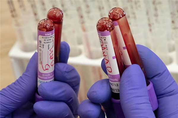 Как передается вирус гепатита В