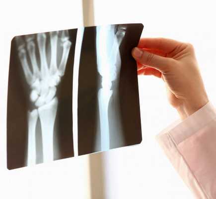 лучезапястный ортез