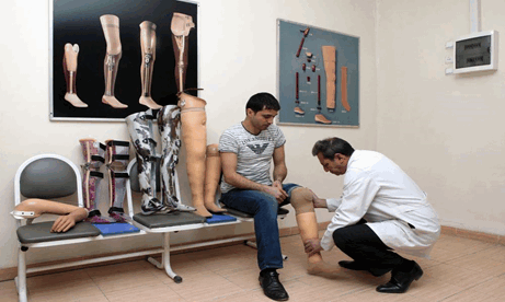 Протезирование нижних конечностей