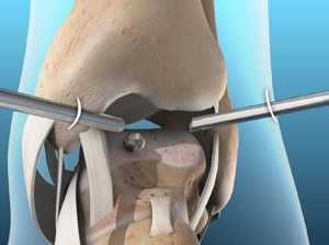 Голеностопный сустав