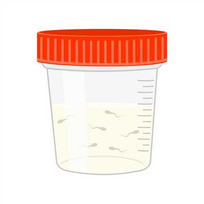 Варикоцеле