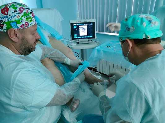 Единственная клиника в России, где удаляют варикозные вены на стопе лазером