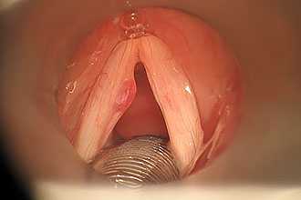 Голосовые связки