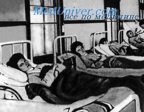 Илеус. Послеоперационный паралитический илеус