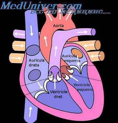 стенокардия