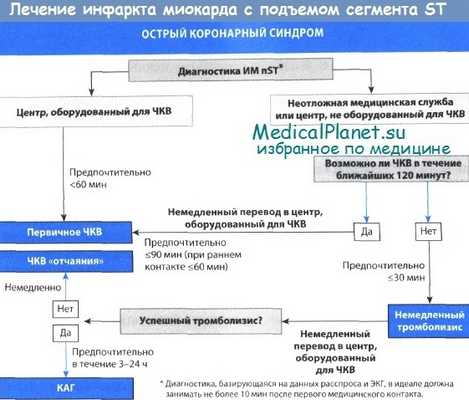 Лечение инфаркта миокарда с подъемом сегмента ST