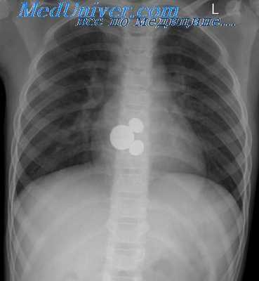 экспозиция рентгеновского снимка