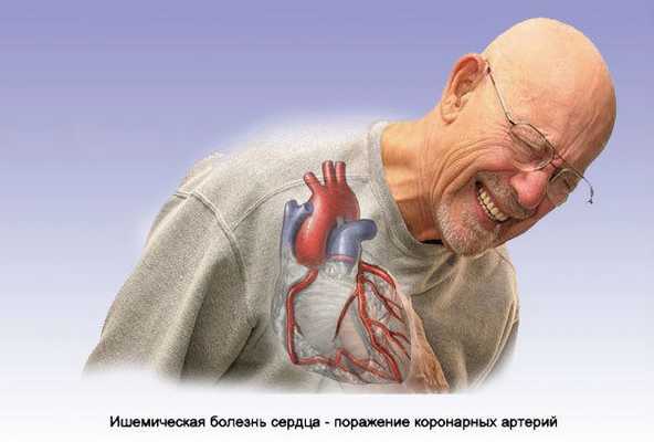 Боль в груди