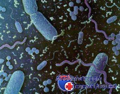 венерическая лимфогранулема