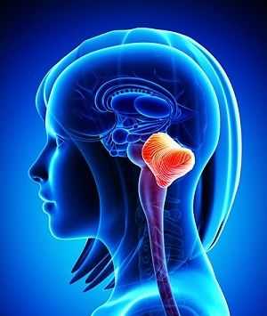 Болезнь Денди-Уокера