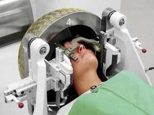 Радиохирургия головного мозга