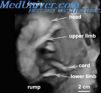 скорость кровотока у плода