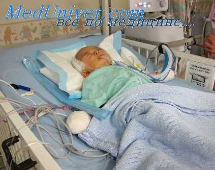 сердечно-легочный препарат