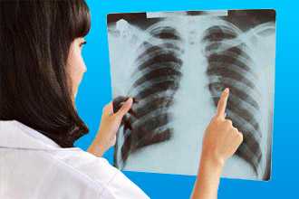 Диагностика легочного сердца