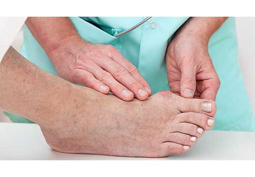 Деформация стопы