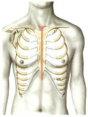 Доступ через срединную стернотомию.