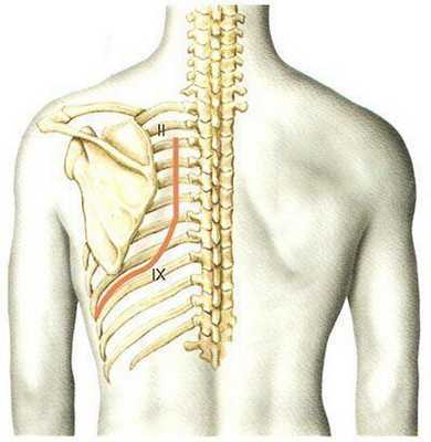 Заднебоковой доступ.
