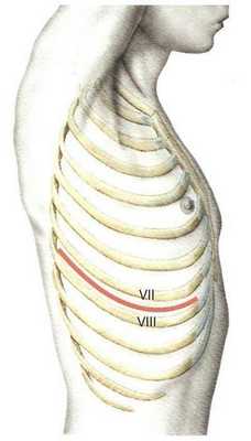 Нижний переднебоковой доступ.