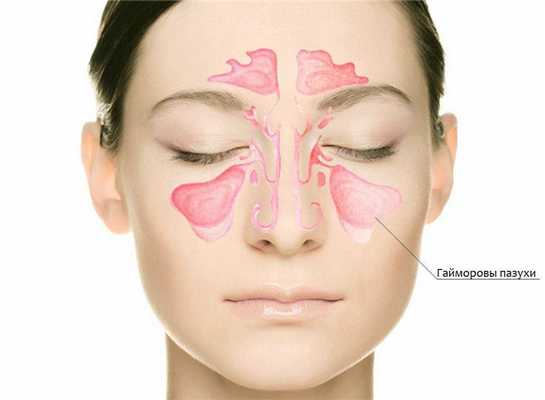 Гайморовы пазухи