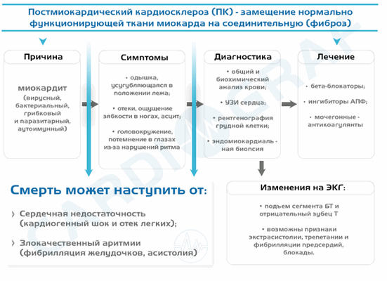 Кардиосклероз