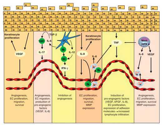 Псориаз кожи