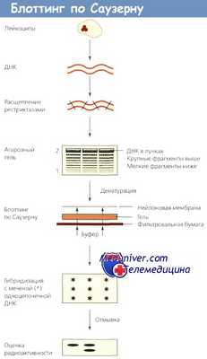 Саузерн блоттинг ДНК