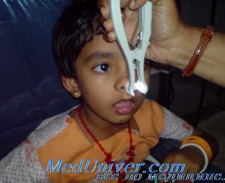 техника риноскопии