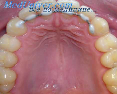 положение зубов