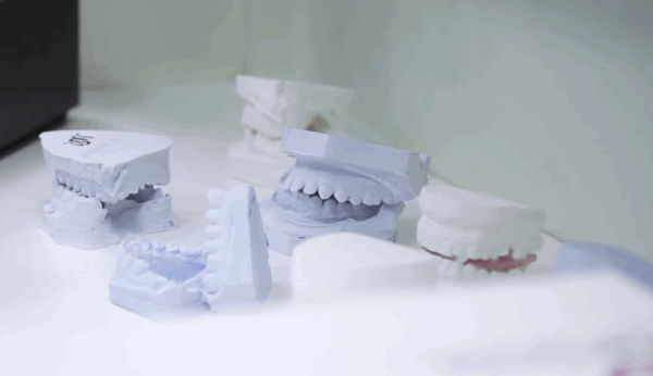 Коррекция щелей между зубами