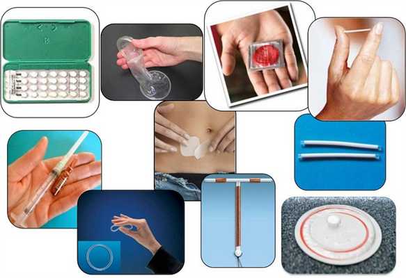 Методы современной контрацепции