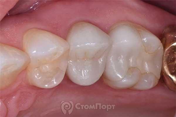 8. После финишной полировки
