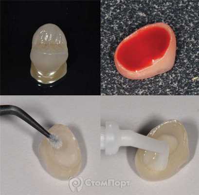 1. Нанесение керамического бонда