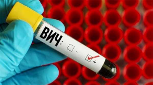 Первые признаки ВИЧ