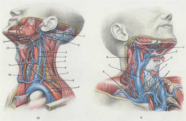 Рис. 10— 11. Варианты строения яремных вен. Рис. 10. 1 — задняя ушная вена; 2 — занижнечелюстная вена; 3 — левая внутренняя яремная вена; 4 — блуждающий нерв; 5 — левая наружная яремная вена (магистральный тип строения); 6 — шейная петля; 7 — плечевое сплетение; 8 — сухожилие лопаточноподъязычной мышцы; 9 — подключичные артерии и вена; 10 — левая передняя яремная вена; 11 — верхняя шитовидная вена; 12— подъязычная кость; 13 — лицевые вена и артерия (грудино-ключично-сосцевидная мышца и часть ключицы удалены). Рис. 11. 1 — лицевая вена; 2 — язычная вена; 3 — шитовидный хрящ; 4 — правая внутренняя яремная вена; 5 — передняя яремная вена (сетевидный тип строения); 6 — правая подключичная вена; 7 — правая общая сонная артерия; 8 — грудино-ключично-сосцевидная мышца (отсечена).