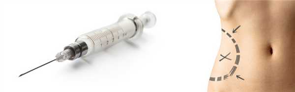 Шприцевая-липосакция