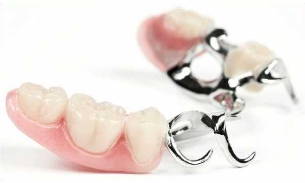 Мостовидный протез