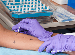 Диагностика кожных заболеваний