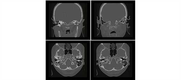 Рентген кистей рук