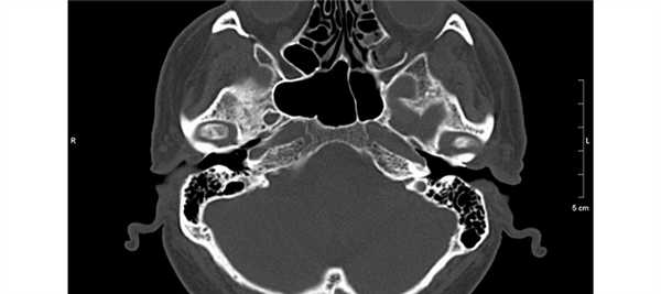 Рентген кистей рук