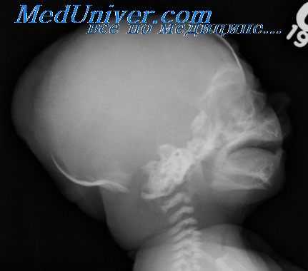 висцеральный скелет