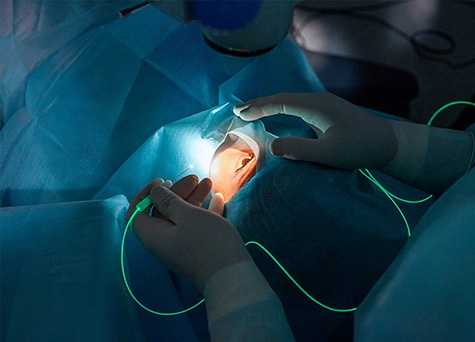 Витрэктомия глаза: операция и послеоперационный период