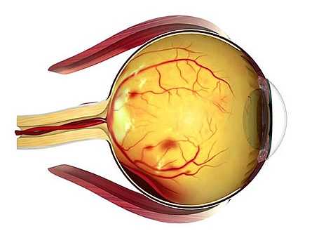 Фоновая (вторичная) ретинопатия