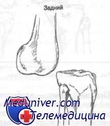 передний вывих коленного сустава