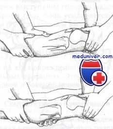 передний вывих коленного сустава