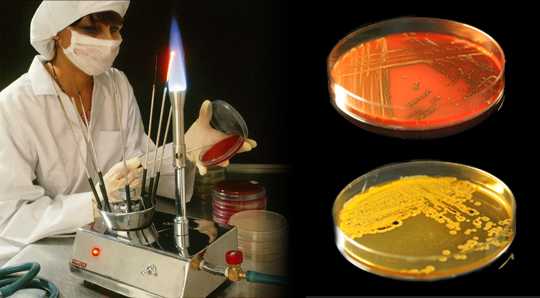 Бактериологический посев на уреаплазму