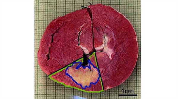 Фото сердца