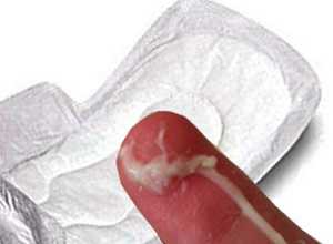 Белые выделения на пальце и на прокладке