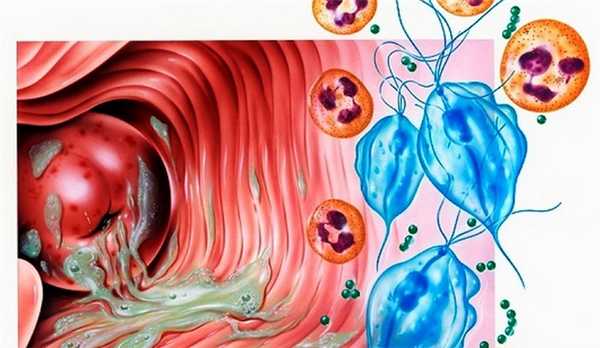 Диагностика пр наличии нехороших выделений из влагалища и шейки матки