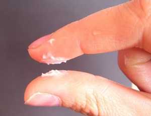 Белые выделения у девушки на пальцах