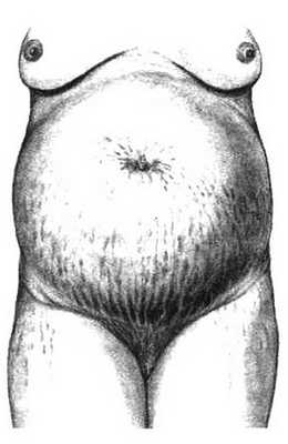 Диагностика беременности